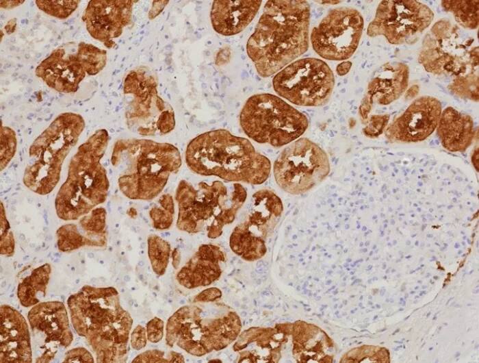 FABP1/L-FABP Antibody (FABP1/9085R) - Azide and BSA Free Immunohistochemistry-Paraffin: FABP1/L-FABP Antibody (FABP1/9085R) - Azide and BSA Free [NBP3-24046] -