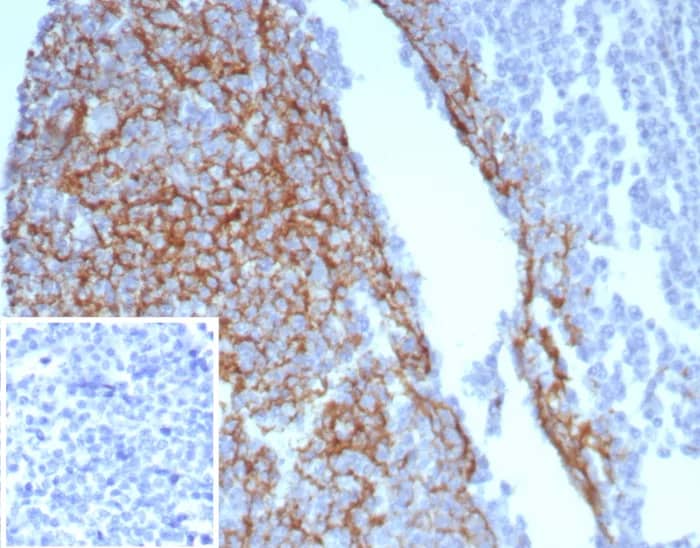 CD23/Fc epsilon RII Antibody (FCER2/8234R) - Azide and BSA Free Immunohistochemistry-Paraffin: CD23/Fc epsilon RII Antibody (FCER2/8234R) - Azide and BSA Free [NBP3-24047] -