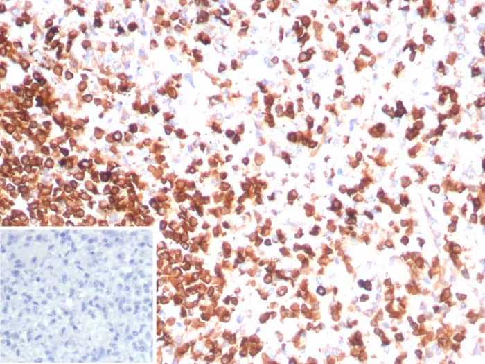 CD3 epsilon Antibody (rC3e/8881) - Azide and BSA Free Immunohistochemistry-Paraffin: CD3 epsilon Antibody (rC3e/8881) - Azide and BSA Free [NBP3-24048] -