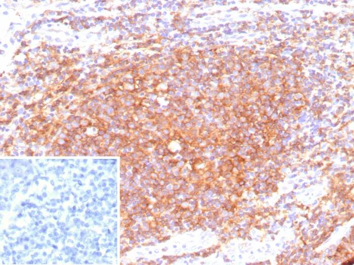 CD40/TNFRSF5 Antibody (C40/9225R) - Azide and BSA Free Immunohistochemistry-Paraffin: CD40/TNFRSF5 Antibody (C40/9225R) - Azide and BSA Free [NBP3-24062] -