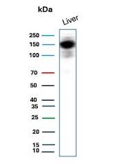 CPS1 Antibody (CPS1/9151R) - Azide and BSA Free Western Blot: CPS1 Antibody (CPS1/9151R) - Azide and BSA Free [NBP3-24076] -