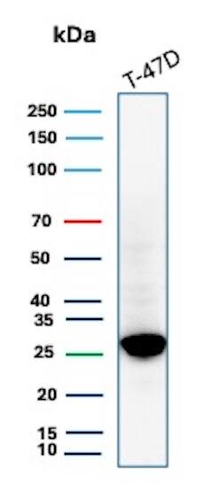 GSTM3 Antibody (rGSTM3/8878) - Azide and BSA Free Western Blot: GSTM3 Antibody (rGSTM3/8878) - Azide and BSA Free [NBP3-24085] -