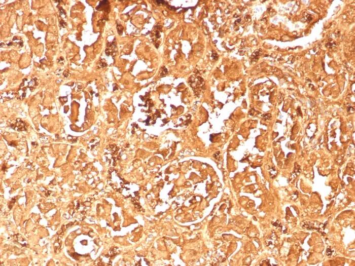 Hemoglobin A2 Antibody (rHBA/9167) - Azide and BSA Free Immunohistochemistry-Paraffin: Hemoglobin A2 Antibody (rHBA/9167) - Azide and BSA Free [NBP3-24089] -
