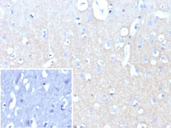 L1CAM Antibody (L1CAM/9146R) - Azide and BSA Free Immunohistochemistry-Paraffin: L1CAM Antibody (L1CAM/9146R) - Azide and BSA Free [NBP3-24102] -