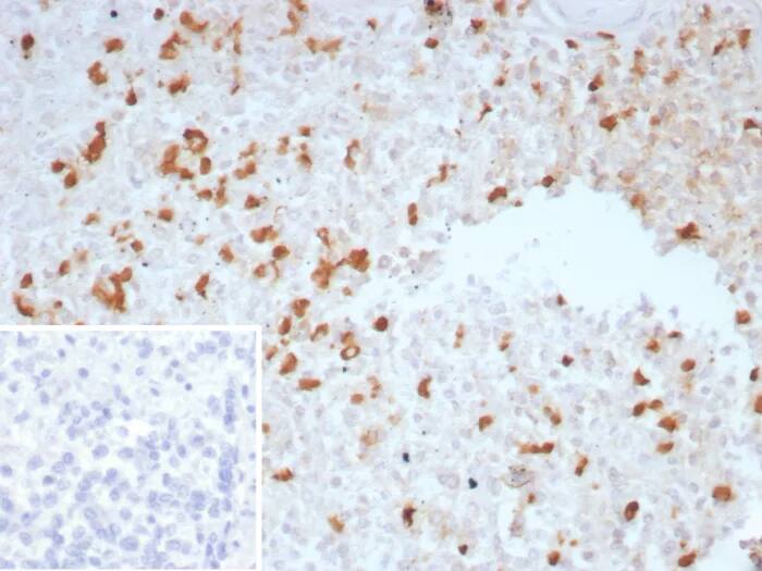 TGF-beta Antibody (TGFB/7230) - Azide and BSA Free Immunohistochemistry-Paraffin: TGF-beta Antibody (TGFB/7230) - Azide and BSA Free [NBP3-24125] -