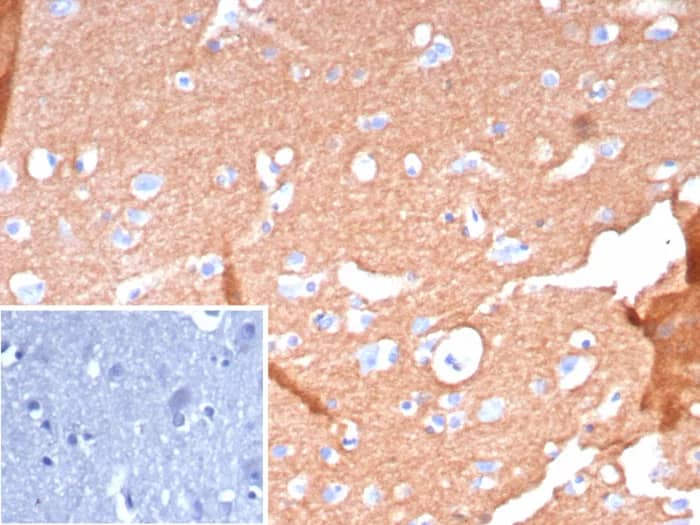 L1CAM Antibody (L1CAM/9267R) - Azide and BSA Free Immunohistochemistry-Paraffin: L1CAM Antibody (L1CAM/9267R) - Azide and BSA Free [NBP3-24129] -