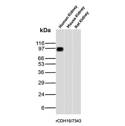 Cadherin-16 Antibody (rCDH16/7343) - Azide and BSA Free Western Blot: Cadherin-16 Antibody (rCDH16/7343) - Azide and BSA Free [NBP3-24130] -
