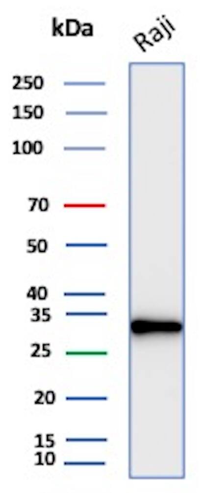 CD20 Antibody (rMS4A1/8044) - Azide and BSA Free Western Blot: CD20 Antibody (rMS4A1/8044) - Azide and BSA Free [NBP3-24142] -