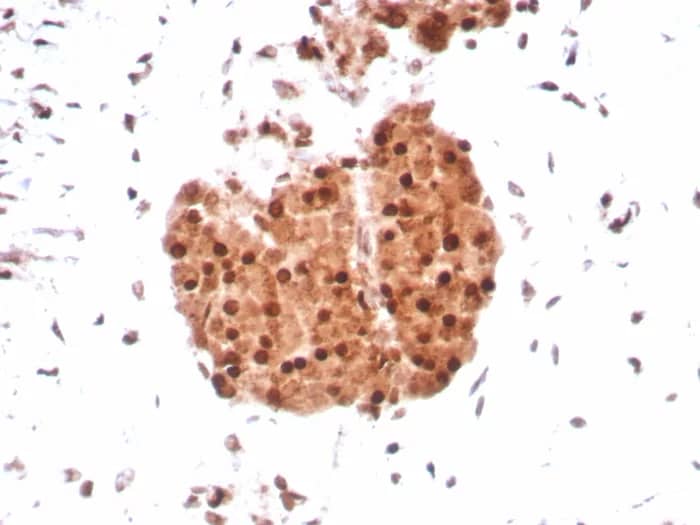 SNF5 Antibody (SMARCB1/8851R) - Azide and BSA Free Immunohistochemistry-Paraffin: SNF5 Antibody (SMARCB1/8851R) - Azide and BSA Free [NBP3-24144] -