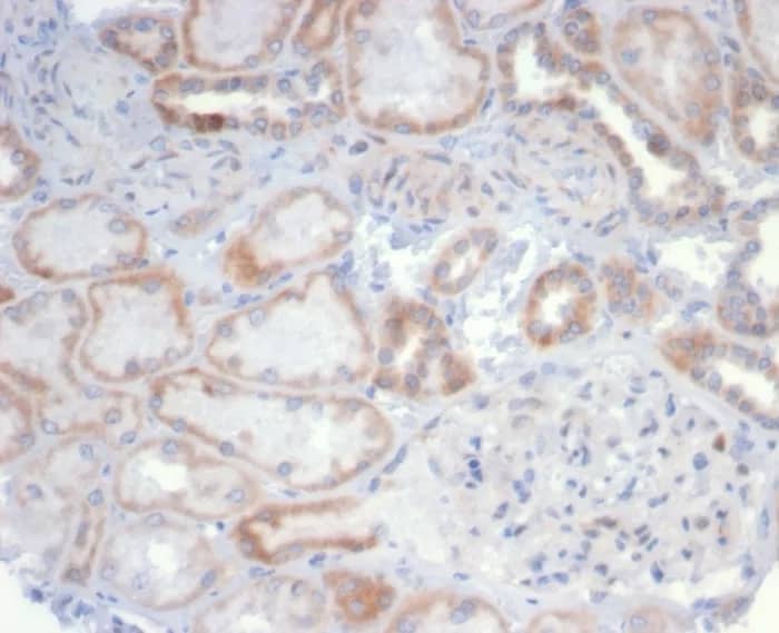 CD20 Antibody (MS4A1/6993R) - Azide and BSA Free Immunohistochemistry-Paraffin: CD20 Antibody (MS4A1/6993R) - Azide and BSA Free [NBP3-24154] -