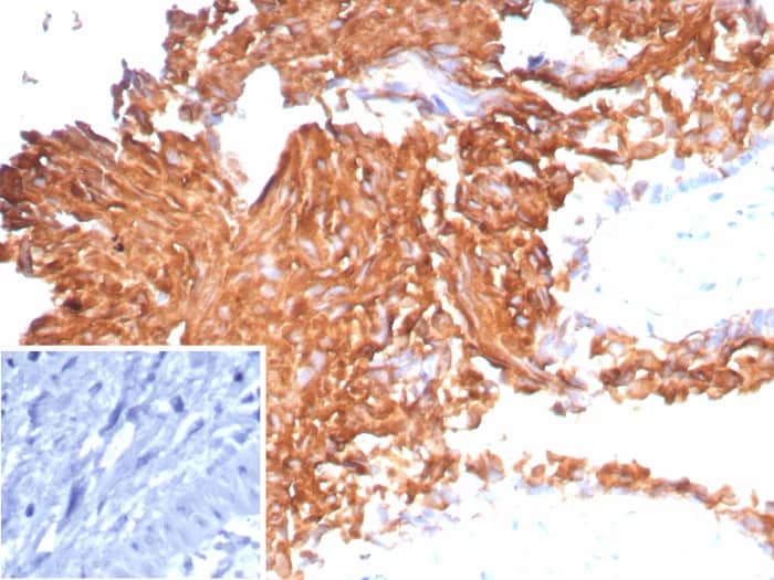 Uroplakin Ib Antibody (UPK1B/9258R) - Azide and BSA Free Immunohistochemistry-Paraffin: Uroplakin Ib Antibody (UPK1B/9258R) - Azide and BSA Free [NBP3-24164] -