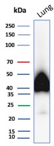 Podoplanin Antibody (PDPN/8950R) - Azide and BSA Free Western Blot: Podoplanin Antibody (PDPN/8950R) - Azide and BSA Free [NBP3-24169] -