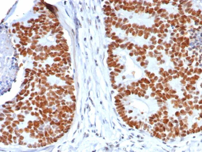 p53 Antibody (rTP53/8063) - Azide and BSA Free Immunohistochemistry-Paraffin: p53 Antibody (rTP53/8063) - Azide and BSA Free [NBP3-24174] -