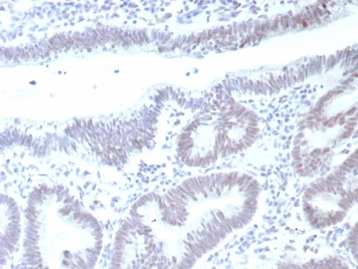 p53 Antibody (rTP53/8993) - Azide and BSA Free Immunohistochemistry-Paraffin: p53 Antibody (rTP53/8993) - Azide and BSA Free [NBP3-24175] -