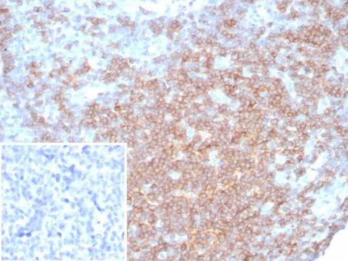 CD27/TNFRSF7 Antibody (LPFS2/8316R) - Azide and BSA Free Immunohistochemistry-Paraffin: CD27/TNFRSF7 Antibody (LPFS2/8316R) - Azide and BSA Free [NBP3-24180] -