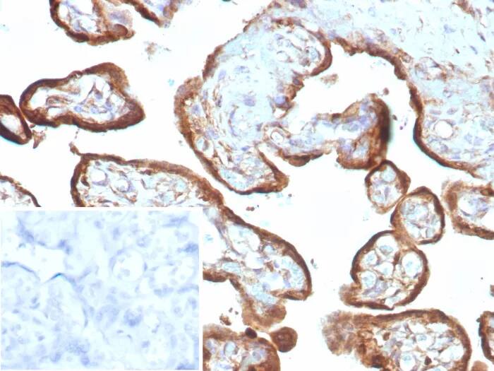 IMP3 Antibody (IMP3/8985R) - Azide and BSA Free Immunohistochemistry-Paraffin: IMP3 Antibody (IMP3/8985R) - Azide and BSA Free [NBP3-24183] -