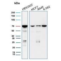 IMP3 Antibody (IMP3/8985R) - Azide and BSA Free Western Blot: IMP3 Antibody (IMP3/8985R) - Azide and BSA Free [NBP3-24183] -