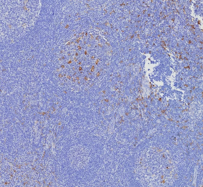 CD163L1 Antibody (CD163L1/7972) - Azide and BSA Free Immunohistochemistry-Paraffin: CD163L1 Antibody (CD163L1/7972) - Azide and BSA Free [NBP3-24185] -
