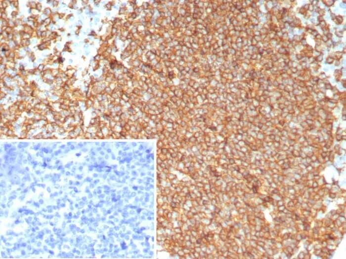 CD20 Antibody (MS4A1/8072R) - Azide and BSA Free Immunohistochemistry-Paraffin: CD20 Antibody (MS4A1/8072R) - Azide and BSA Free [NBP3-24187] -