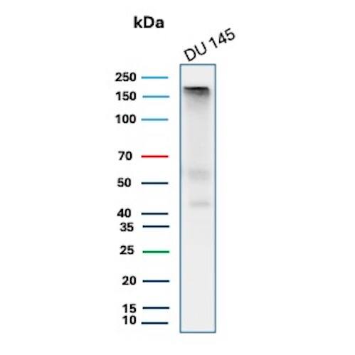 MSH6 Antibody (MSH6/8338R) - Azide and BSA Free Western Blot: MSH6 Antibody (MSH6/8338R) - Azide and BSA Free [NBP3-24204] -