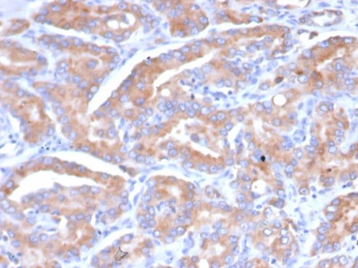 CHID1 Antibody (CHID1/6368) - Azide and BSA Free Immunohistochemistry-Paraffin: CHID1 Antibody (CHID1/6368) - Azide and BSA Free [NBP3-24214] -