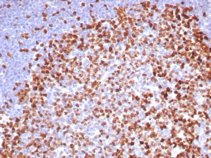 Ki67/MKI67 Antibody (MKI67/8315R) - Azide and BSA Free Immunohistochemistry-Paraffin: Ki67/MKI67 Antibody (MKI67/8315R) - Azide and BSA Free [NBP3-24219] -