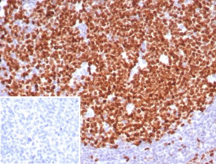 Ki67/MKI67 Antibody (MKI67/8315R) - Azide and BSA Free Immunohistochemistry-Paraffin: Ki67/MKI67 Antibody (MKI67/8315R) - Azide and BSA Free [NBP3-24219] -