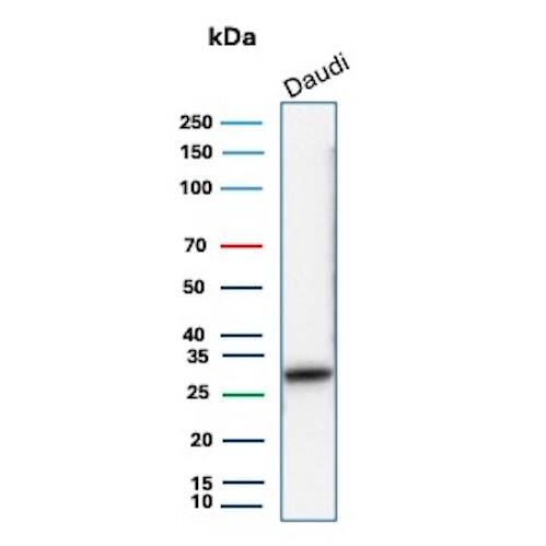 HLA DQ/DR/DP Antibody (HLA-Pan/8311R) - Azide and BSA Free Western Blot: HLA DQ/DR/DP Antibody (HLA-Pan/8311R) - Azide and BSA Free [NBP3-24235] -