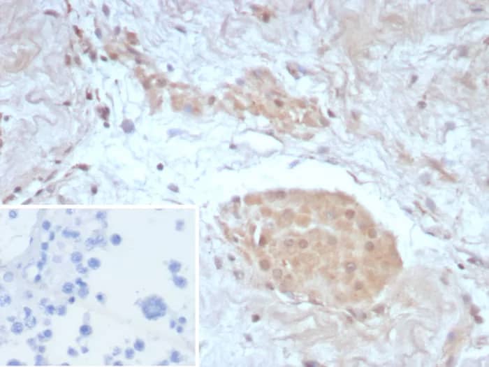 Survivin Antibody (BIRC5/8987R) - Azide and BSA Free Immunohistochemistry-Paraffin: Survivin Antibody (BIRC5/8987R) - Azide and BSA Free [NBP3-24237] -