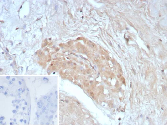 Survivin Antibody (BIRC5/8936R) - Azide and BSA Free Immunohistochemistry-Paraffin: Survivin Antibody (BIRC5/8936R) - Azide and BSA Free [NBP3-24238] -