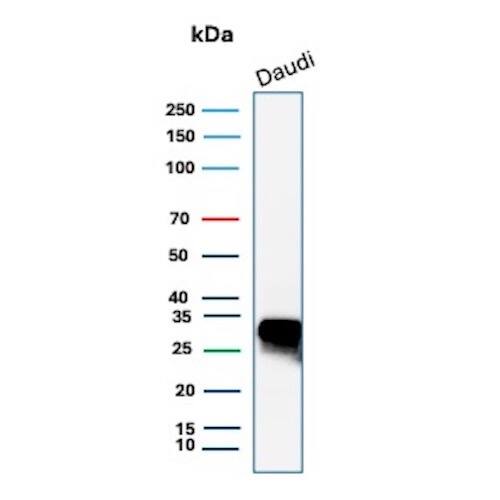 HLA DQ/DR/DP Antibody (HLA-Pan/9268R) - Azide and BSA Free Western Blot: HLA DQ/DR/DP Antibody (HLA-Pan/9268R) - Azide and BSA Free [NBP3-24248] -