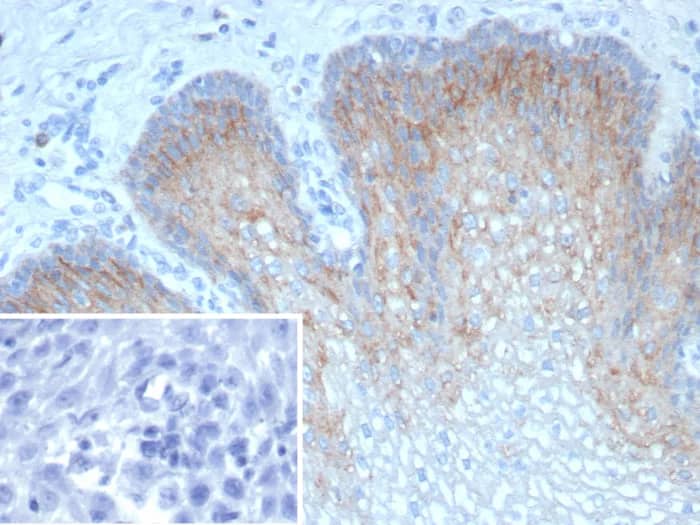 TRIM29 Antibody (TRIM29/9256R) - Azide and BSA Free Immunohistochemistry-Paraffin: TRIM29 Antibody (TRIM29/9256R) - Azide and BSA Free [NBP3-24254] -