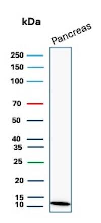 CLPS Antibody (CLPS/9021) - Azide and BSA Free Western Blot: CLPS Antibody (CLPS/9021) - Azide and BSA Free [NBP3-24278] -