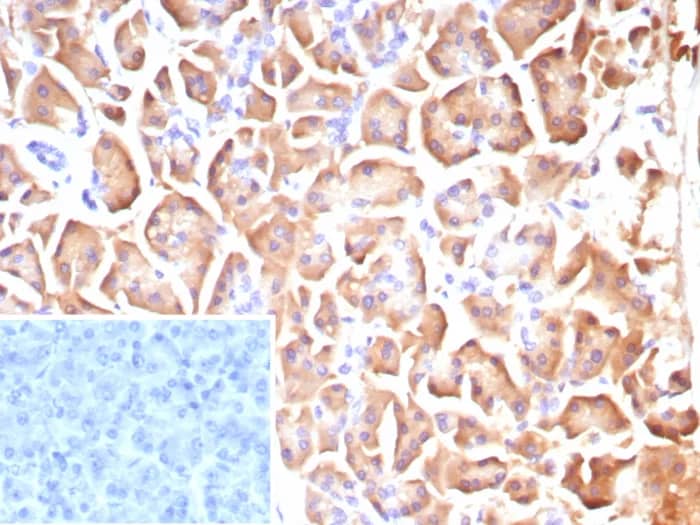 CLPS Antibody (CLPS/9025) - Azide and BSA Free Immunohistochemistry-Paraffin: CLPS Antibody (CLPS/9025) - Azide and BSA Free [NBP3-24283] -