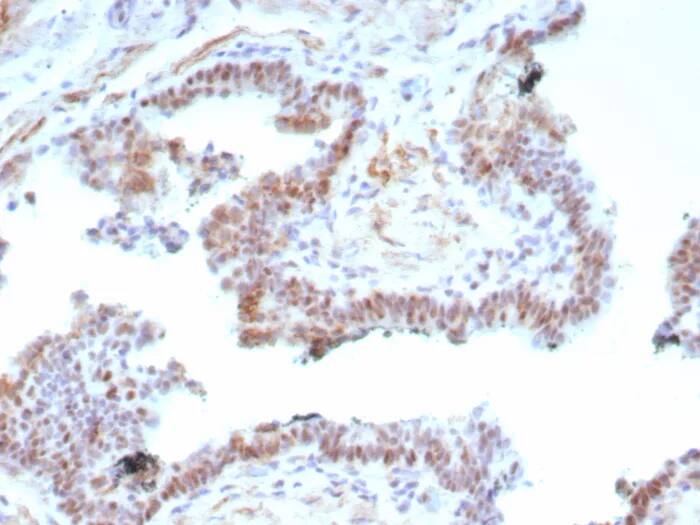 Androgen Receptor V7 Antibody (DHTR.V7/9125R) - Azide and BSA Free Immunohistochemistry-Paraffin: Androgen Receptor V7 Antibody (DHTR.V7/9125R) - Azide and BSA Free [NBP3-24285] -