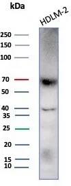 Perforin Antibody (rPRF1/8058) - Azide and BSA Free Western Blot: Perforin Antibody (rPRF1/8058) - Azide and BSA Free [NBP3-24297] -