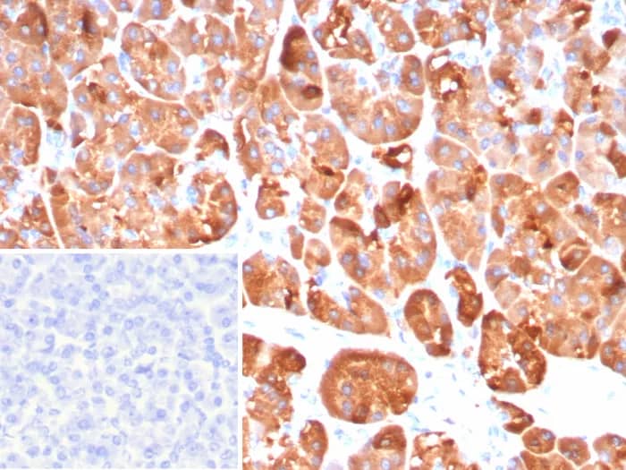 CLPS Antibody (CLPS/9026) - Azide and BSA Free Immunohistochemistry-Paraffin: CLPS Antibody (CLPS/9026) - Azide and BSA Free [NBP3-24301] -