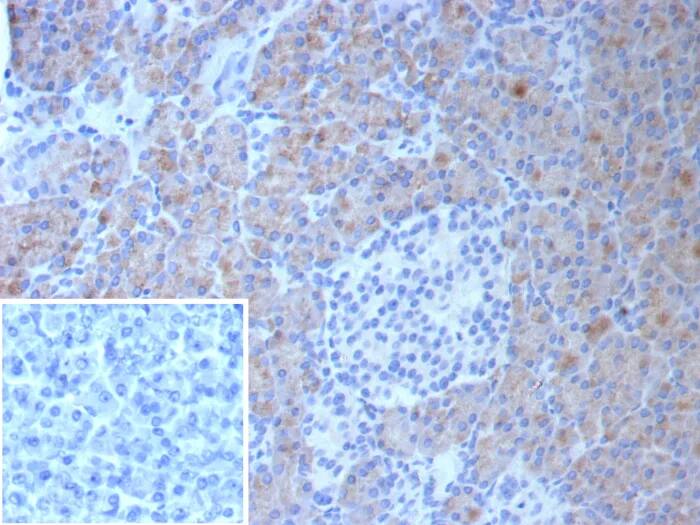 CLPS Antibody (CLPS/9027) - Azide and BSA Free Immunohistochemistry-Paraffin: CLPS Antibody (CLPS/9027) - Azide and BSA Free [NBP3-24302] -