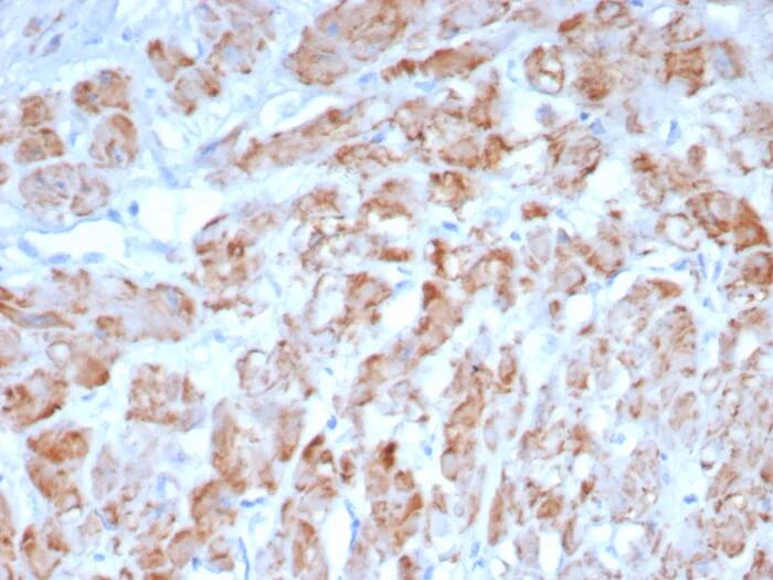 Myosin heavy chain 11 Antibody (MYH11/8185R) - Azide and BSA Free Immunohistochemistry-Paraffin: Myosin heavy chain 11 Antibody (MYH11/8185R) - Azide and BSA Free [NBP3-24304] -