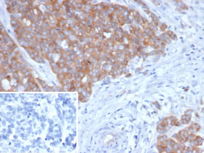 BRAF35 Antibody (BRAF/1323) - Azide and BSA Free Immunohistochemistry-Paraffin: BRAF35 Antibody (BRAF/1323) - Azide and BSA Free [NBP3-24308] -