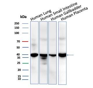 BRAF35 Antibody (BRAF/1323) - Azide and BSA Free Western Blot: BRAF35 Antibody (BRAF/1323) - Azide and BSA Free [NBP3-24308] -
