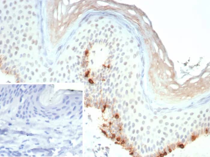 Melan-A/MART-1 Antibody (rMLANA/9404) - Azide and BSA Free Immunohistochemistry-Paraffin: Melan-A/MART-1 Antibody (rMLANA/9404) - Azide and BSA Free [NBP3-24314] -