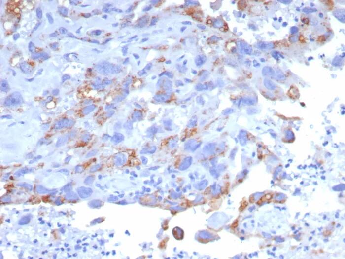 GPRC5A/RAI3 Antibody (GPRC5A/7893) - Azide and BSA Free Immunohistochemistry-Paraffin: GPRC5A/RAI3 Antibody (GPRC5A/7893) - Azide and BSA Free [NBP3-24315] -
