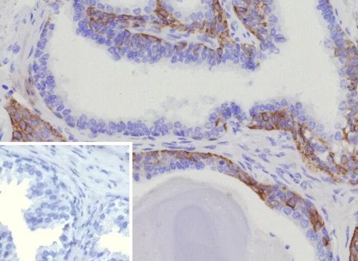 Cytokeratin 15 Antibody (KRT15/9088R) - Azide and BSA Free Immunohistochemistry-Paraffin: Cytokeratin 15 Antibody (KRT15/9088R) - Azide and BSA Free [NBP3-24326] -