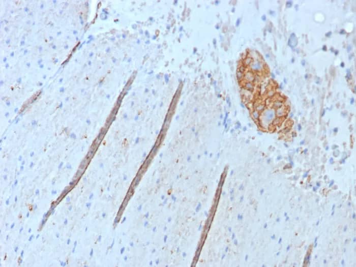 NCAM-1/CD56 Antibody (NCAM1/9074R) - Azide and BSA Free Immunohistochemistry-Paraffin: NCAM-1/CD56 Antibody (NCAM1/9074R) - Azide and BSA Free [NBP3-24334] -