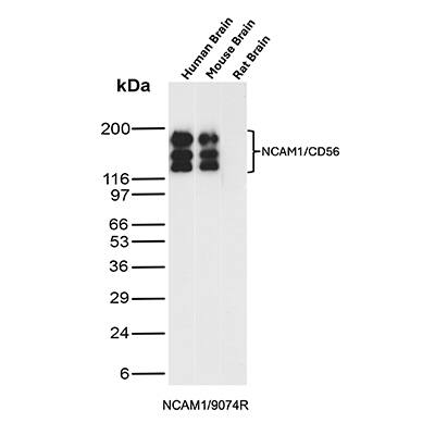 NCAM-1/CD56 Antibody (NCAM1/9074R) - Azide and BSA Free Western Blot: NCAM-1/CD56 Antibody (NCAM1/9074R) - Azide and BSA Free [NBP3-24334] -