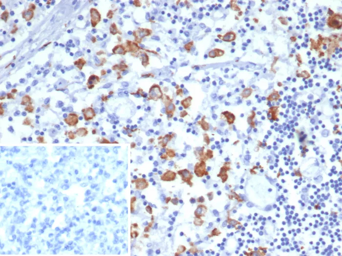 CD163L1 Antibody (CD163L1/7974) - Azide and BSA Free Immunohistochemistry-Paraffin: CD163L1 Antibody (CD163L1/7974) - Azide and BSA Free [NBP3-24337] -