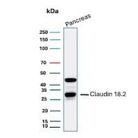 Claudin-18.2 Antibody (CLDN18.2/8559R) - Azide and BSA Free Western Blot: Claudin-18.2 Antibody (CLDN18.2/8559R) - Azide and BSA Free [NBP3-24338] -