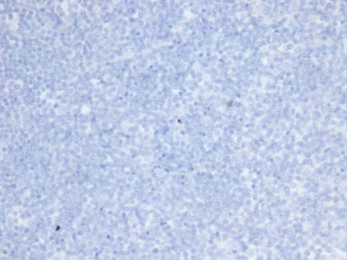 ErbB2/Her2 Antibody (rERBB2/6637) - Azide and BSA Free Immunohistochemistry-Paraffin: ErbB2/Her2 Antibody (rERBB2/6637) - Azide and BSA Free [NBP3-24341] -
