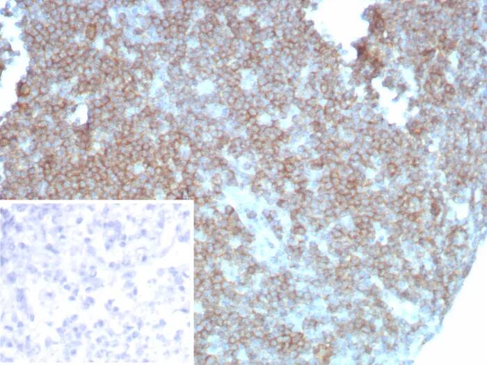 CD27/TNFRSF7 Antibody (LPFS2/8838R) - Azide and BSA Free Immunohistochemistry-Paraffin: CD27/TNFRSF7 Antibody (LPFS2/8838R) - Azide and BSA Free [NBP3-24342] -